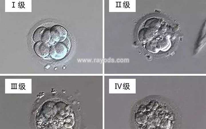 固原中介找代母_试管婴儿胚胎质量是怎么划分的