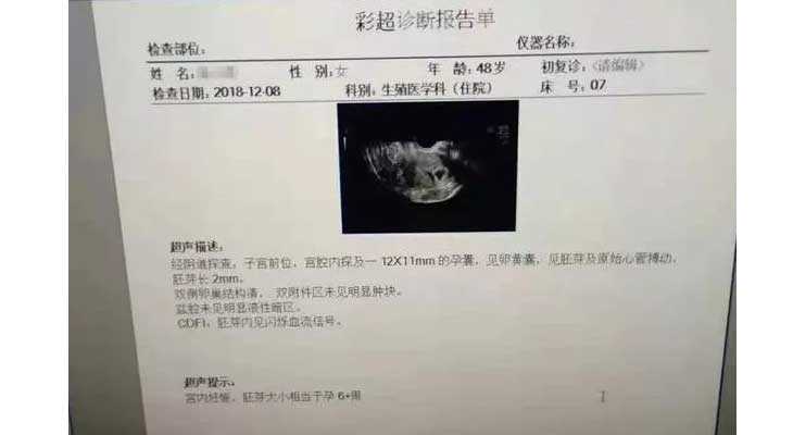 邵东县有私人家庭要找代妈_试管婴儿成功案例经验分享